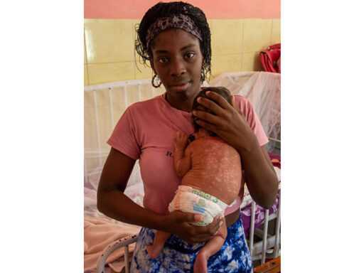 Ashley, una vida salvada del Chikungunya 