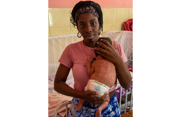 Ashley, una vida salvada del Chikungunya 