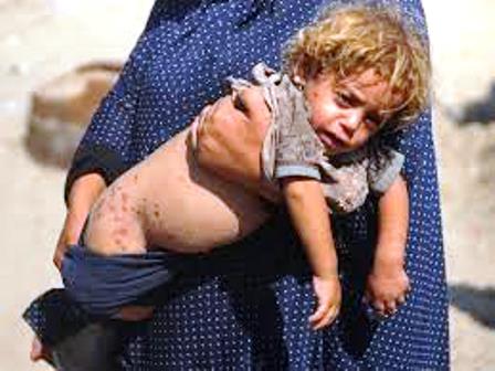 Las enfermedades y epidemias amenazan también a Gaza