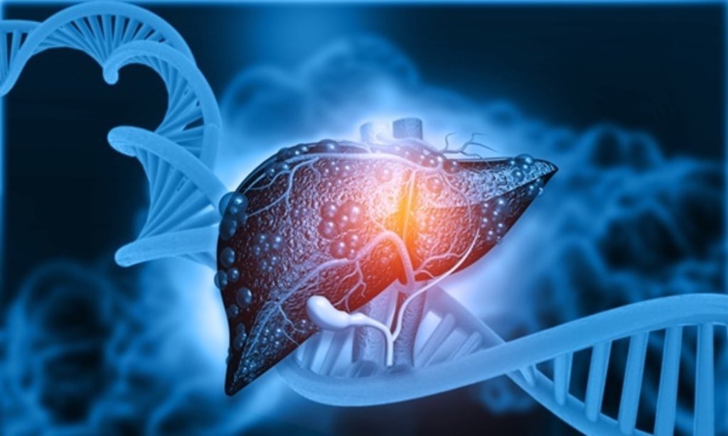 Advierten en Guatemala sobre cirrosis, enfermedad silenciosa