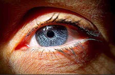 Alertan sobre el riesgo de glaucoma por el uso del tadalafilo